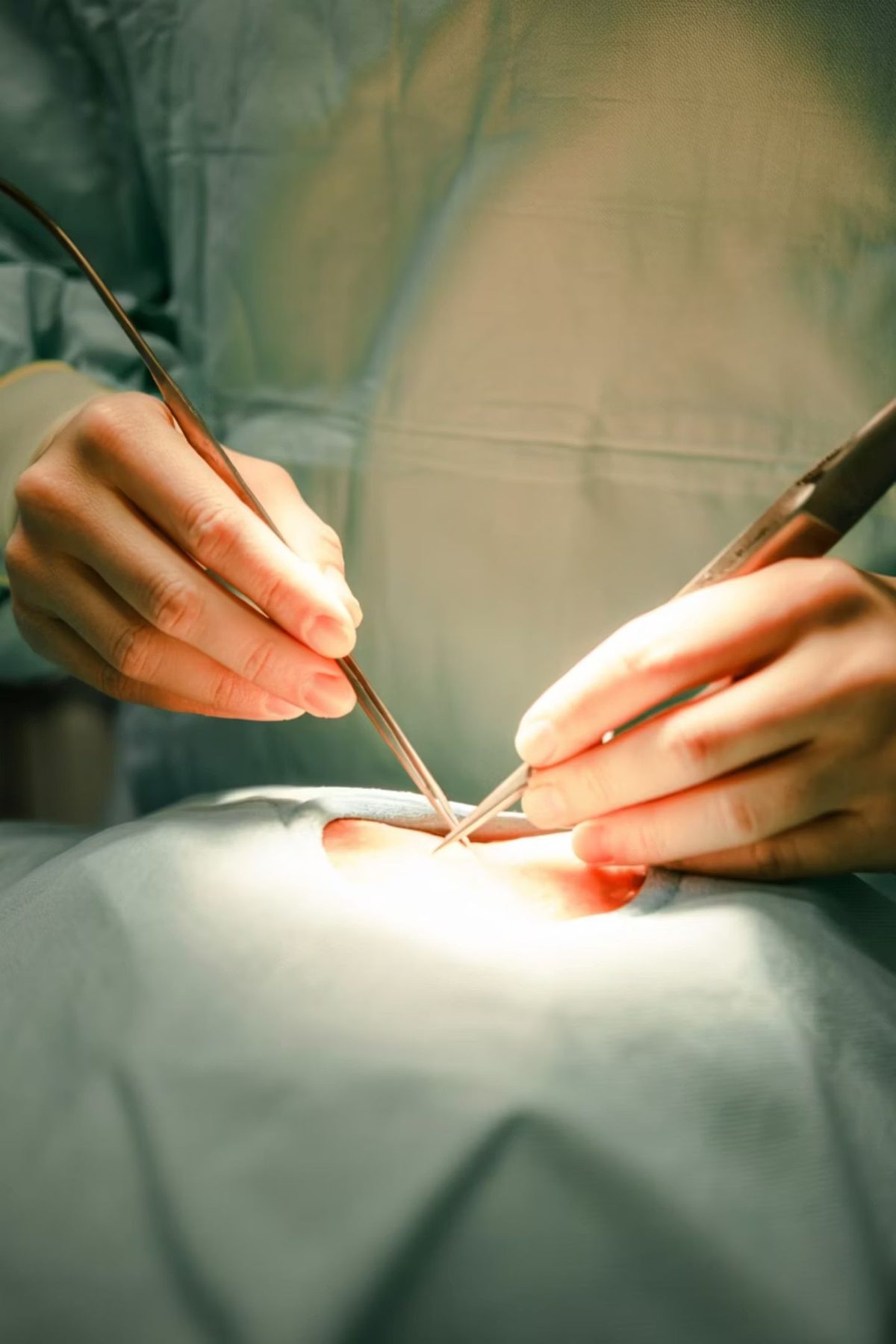 Surgeon's hands performing a precise minimally invasive procedure